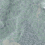 Burke Mountain Resort Preview 3