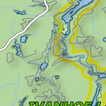 Ontario Provincial Park: Ivanhoe Lake Part 2 Preview 3