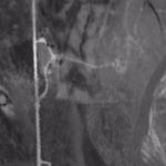 Springs at Confluence