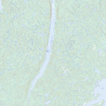 Petit Lac Onatchiway, QC (022E03 Toporama)