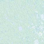 Chabbie Lake (032E12 Toporama)