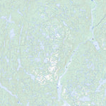 Lac Delage, QC (012P12 Toporama)
